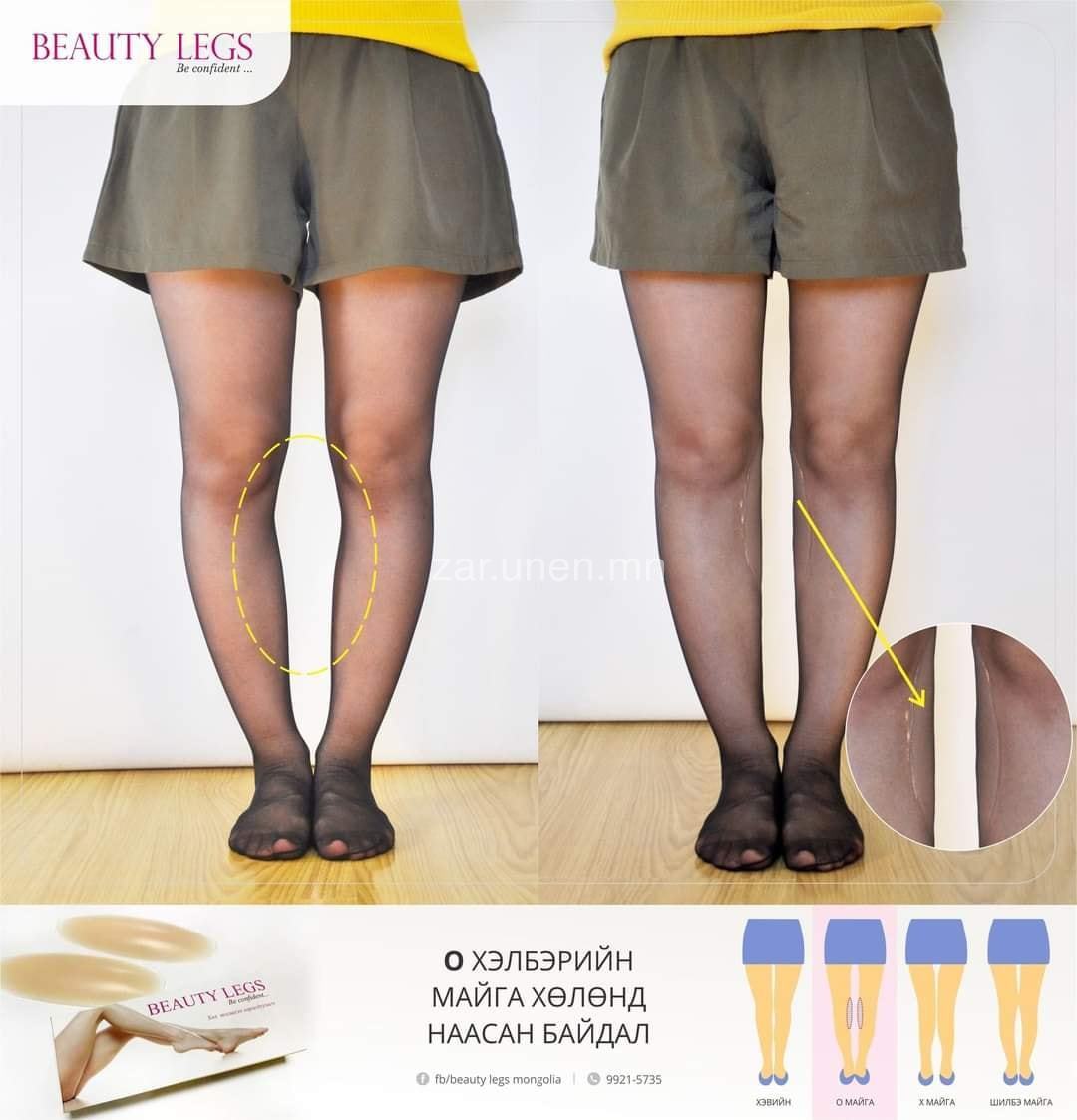 🎀Мэдээлэл🎀 #BEAUTY_LEGS гэж юу вэ? Хэрхэн хэрэглэх вэ? Beauty legs нь 